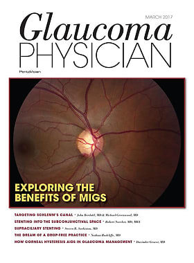 Glaucoma Physician