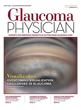 Glaucoma Physician