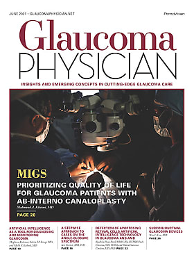 Glaucoma Physician