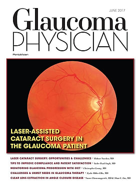 Glaucoma Physician