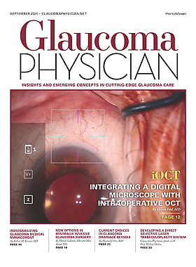 Glaucoma Physician