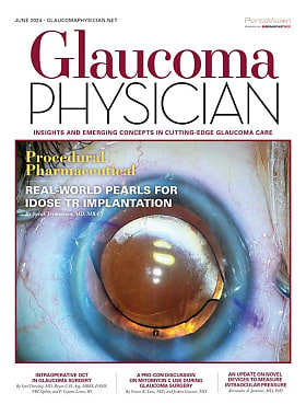 Glaucoma Physician