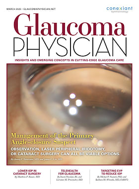 Glaucoma Physician
