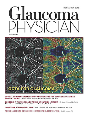 Glaucoma Physician