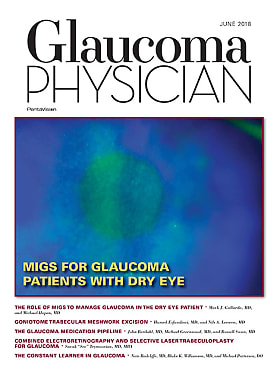 Glaucoma Physician