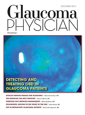 Glaucoma Physician