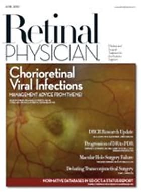 Retinal Physician