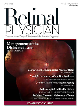 Retinal Physician