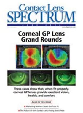 Contact Lens Spectrum