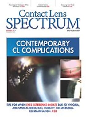 Contact Lens Spectrum