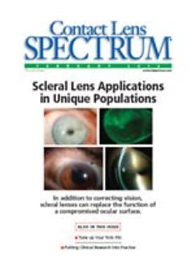 Contact Lens Spectrum