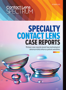 Contact Lens Spectrum