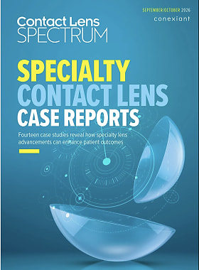 Contact Lens Spectrum