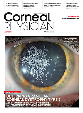 Corneal Physician