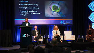 Keratoconus More Common in Children Than Previously Thought