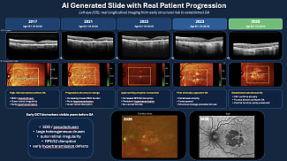 Geographic Atrophy Care in 2026