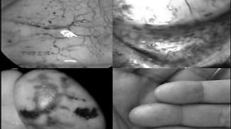 Life-threatening eye signs and symptoms to keep on your radar