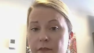 Imaging and Treatments for Dry Age-Related Macular Degeneration