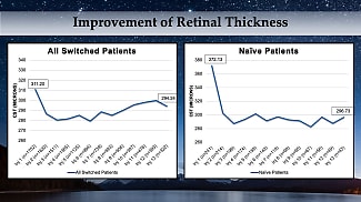 What Retina Specialists Have Learned From TRUCKEE