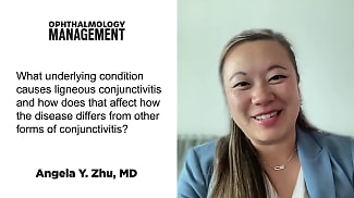 Diving Deeper into Ligneous Conjunctivitis