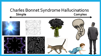 What Visual Hallucinations and Illusions Can Tell ODs About Low Vision