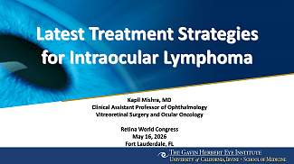 Diagnosing and Treating Ocular Lymphoma
