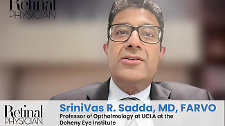 Video: Eliminating SHRM May Improve Visual Outcomes 