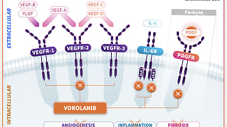 A Potentially Synergistic Approach to Retinal Exudative Diseases