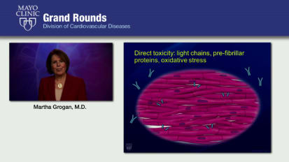 Grand Rounds — Cardiac Amyloidosis: What Every Cardiologist Needs to Know