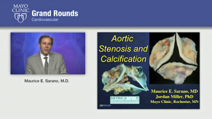 Grand Rounds: Aortic Stenosis and Calcification