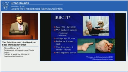 Grand Rounds: The Establishment of a Hand and Face Transplant Center