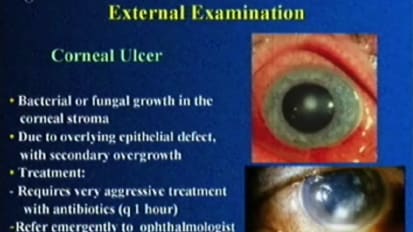 Grand Rounds en Español: Ophthalmologia Básica para Internistas