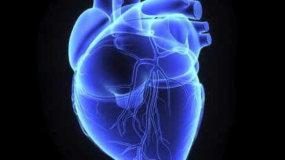 Mayo Clinic spontaneous coronary artery dissection (SCAD) Research Program update: 2015