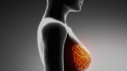 Clinical Minutes: Breast Cancer Screening