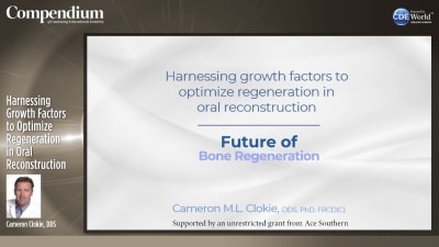 Harnessing Growth Factors to Optimize Regeneration in Oral Reconstruction