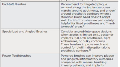 Make Sure You “SPIT”: A Practical Framework for Long-Term Implant Health