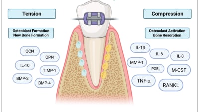 Tumor Necrosis Factor-Alpha Inhibitors: Oral Health and Orthodontic Considerations