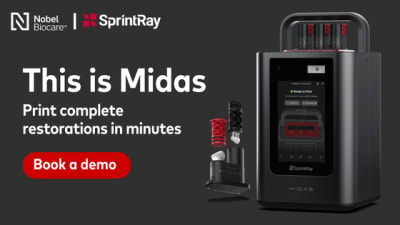 Why Buy Midas from Nobel Biocare