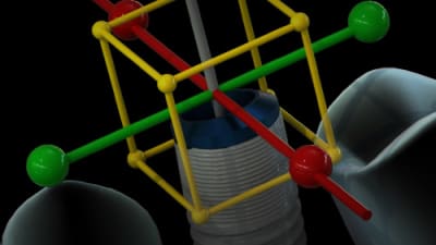 Breakthroughs in Digital Imaging & Surgical Planning | Compendium