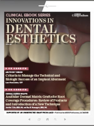 Innovations in Dental Esthetics