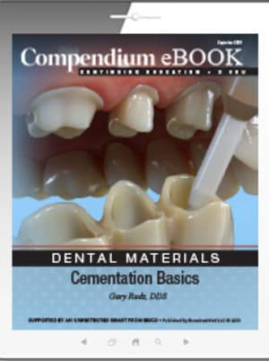 Cementation Basics