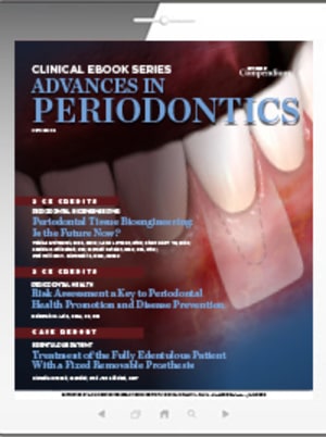 Advances in Periodontics