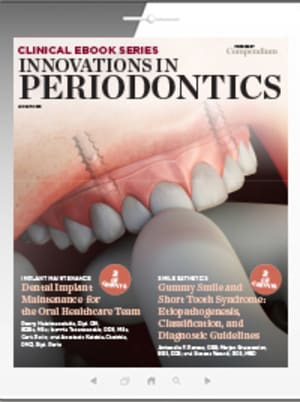 Innovations in Periodontics