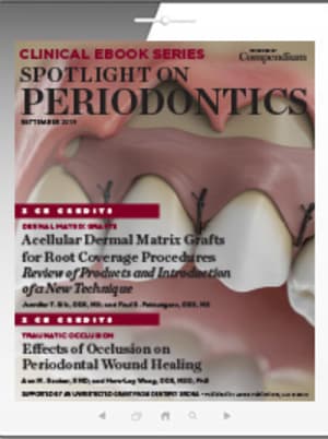 Spotlight on Periodontics