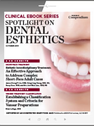 Spotlight on Dental Esthetics