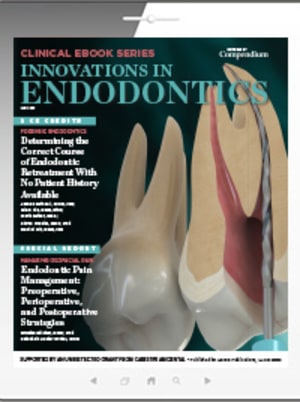 Innovations in Endodontics