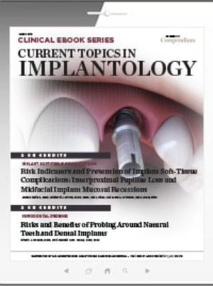 Current Topics in Implantology
