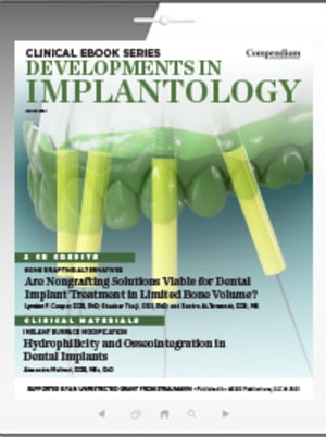 Developments in Implantology