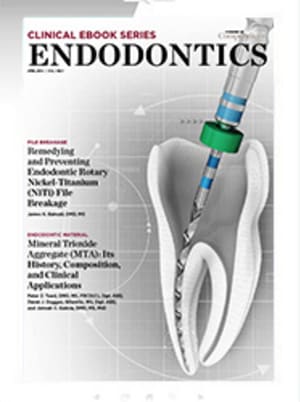 Clinical eBook Series: Endodontics