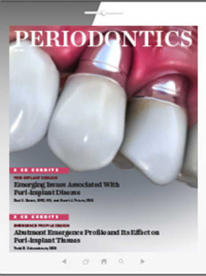 Periodontal Maintenance